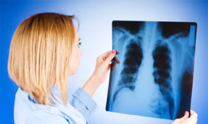 Лікування туберкульозу восковою міллю: дозування